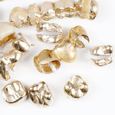 Various dental gold pieces